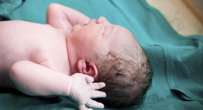 ارتفاع حالات الولادة القيصرية وتكاليفها تصل لمليون ليرة سورية