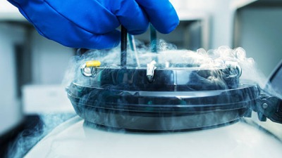 Oocyte cryopreservation